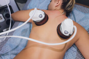 Vacuum Therapy vs. Traditional Liposuction